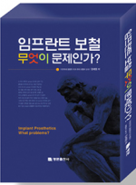 임프란트 보철 무엇이 문제인가? (1.2권 세트)