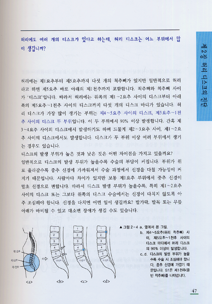 상식을 뛰어넘는 허리병 허리디스크 이야기