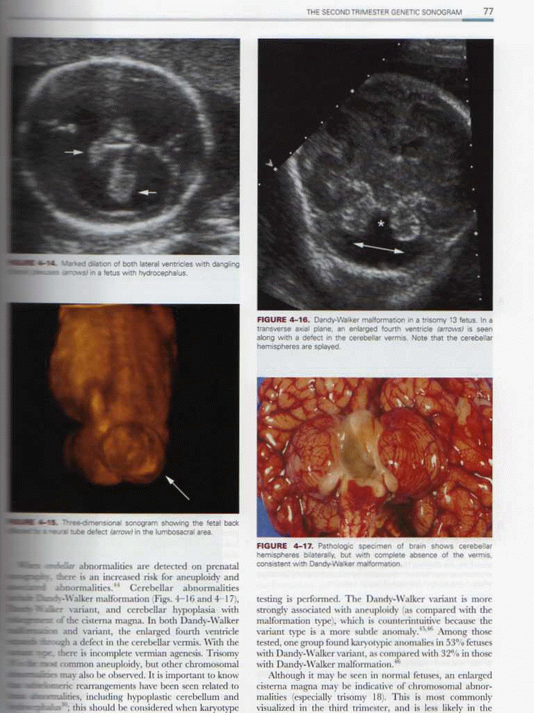 Ultrasonography in Obstetrics & Gynecology,5/e