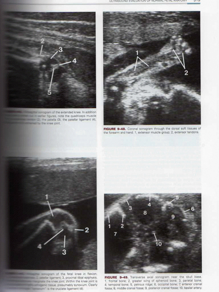 Ultrasonography in Obstetrics & Gynecology,5/e