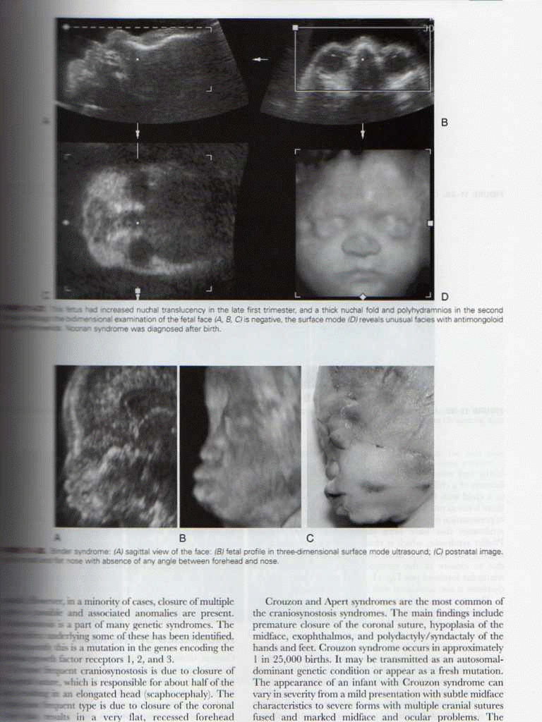 Ultrasonography in Obstetrics & Gynecology,5/e