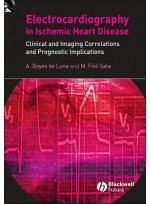 Electrocardiography in Ischemic Heart Disease