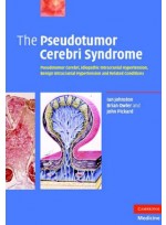 The Pseudotumor Cerebri Syndrome