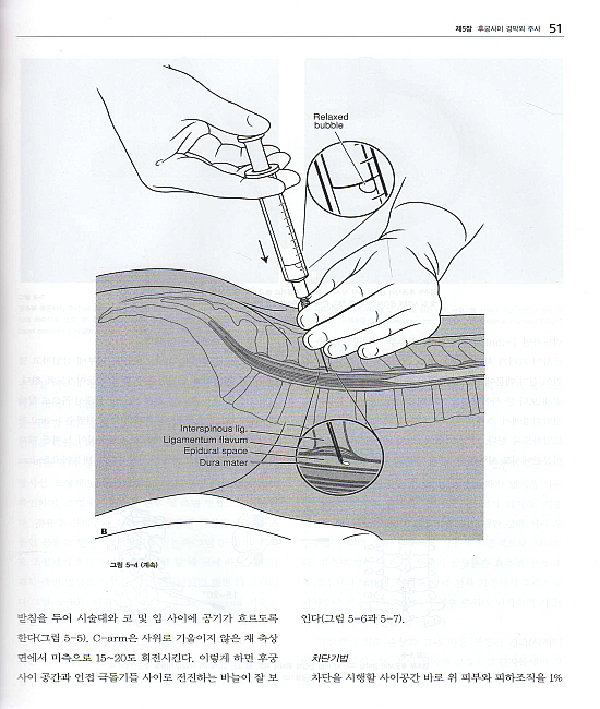 쉽게 배우는 척추주사요법