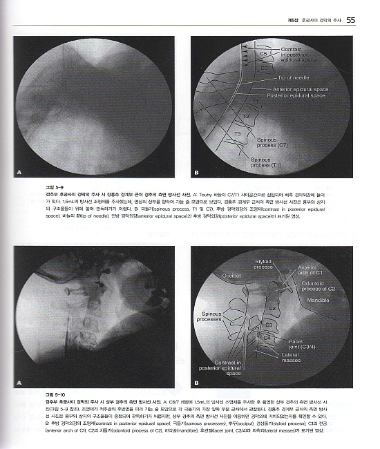 쉽게 배우는 척추주사요법