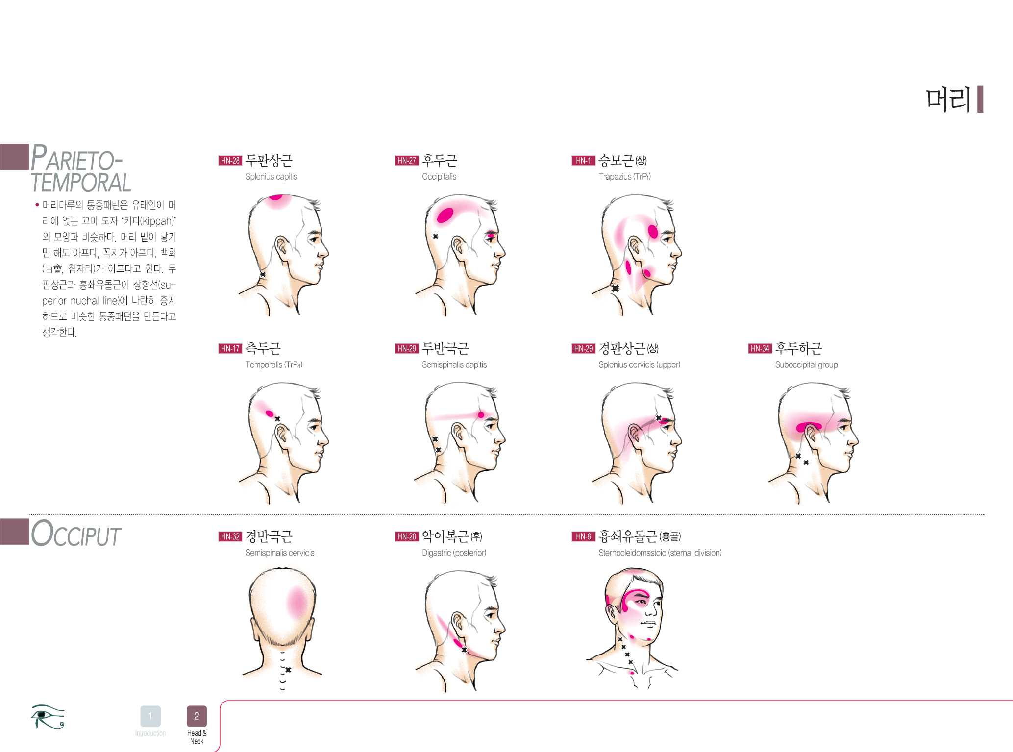 근막통 통증 차트