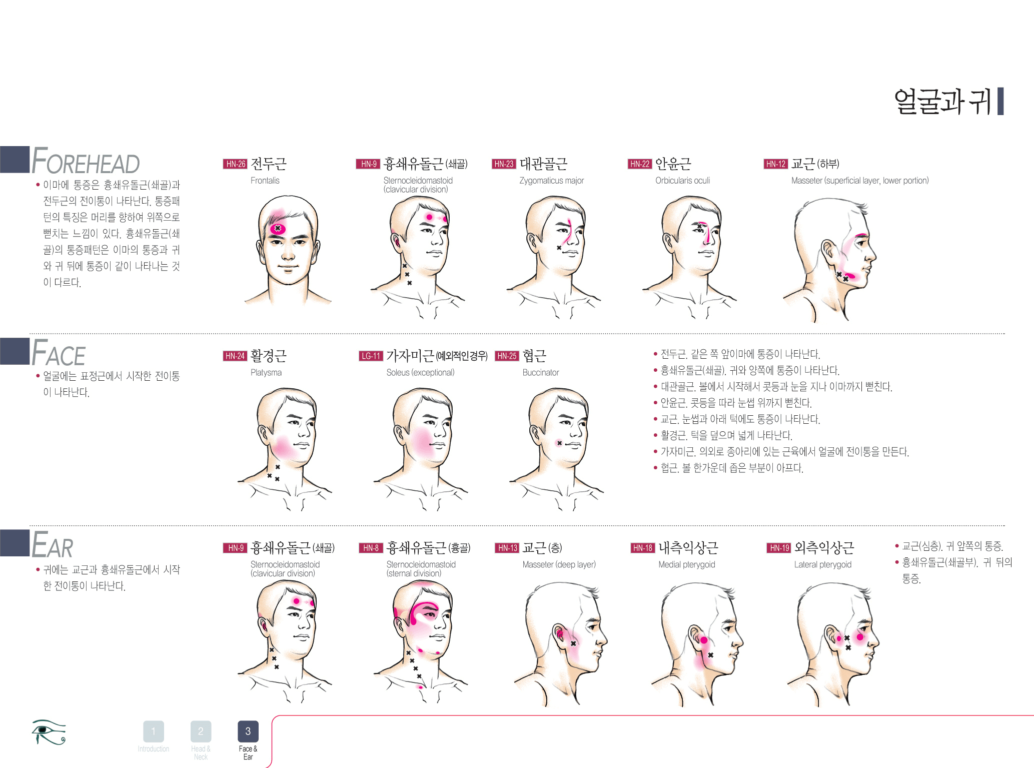 근막통 통증 차트