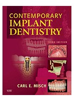 Contemporary Implant Dentistry, 3rd Edition