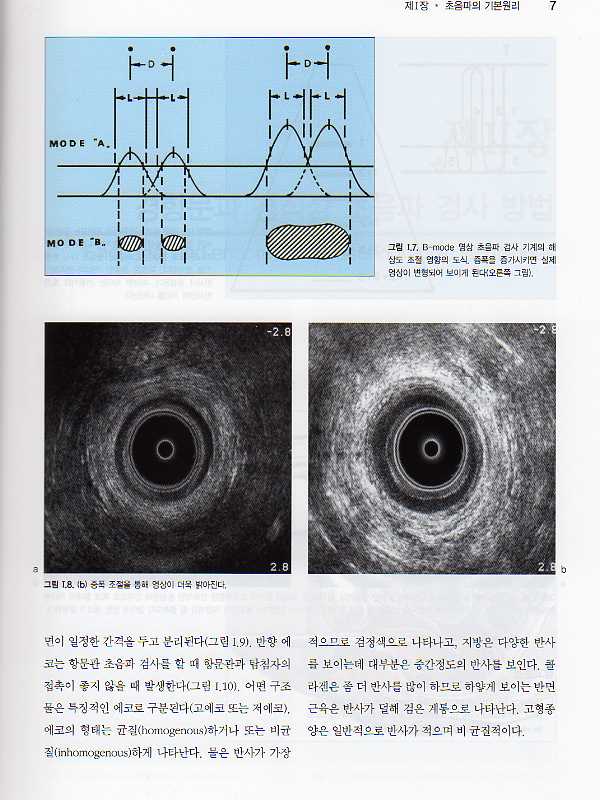 직장항문초음파