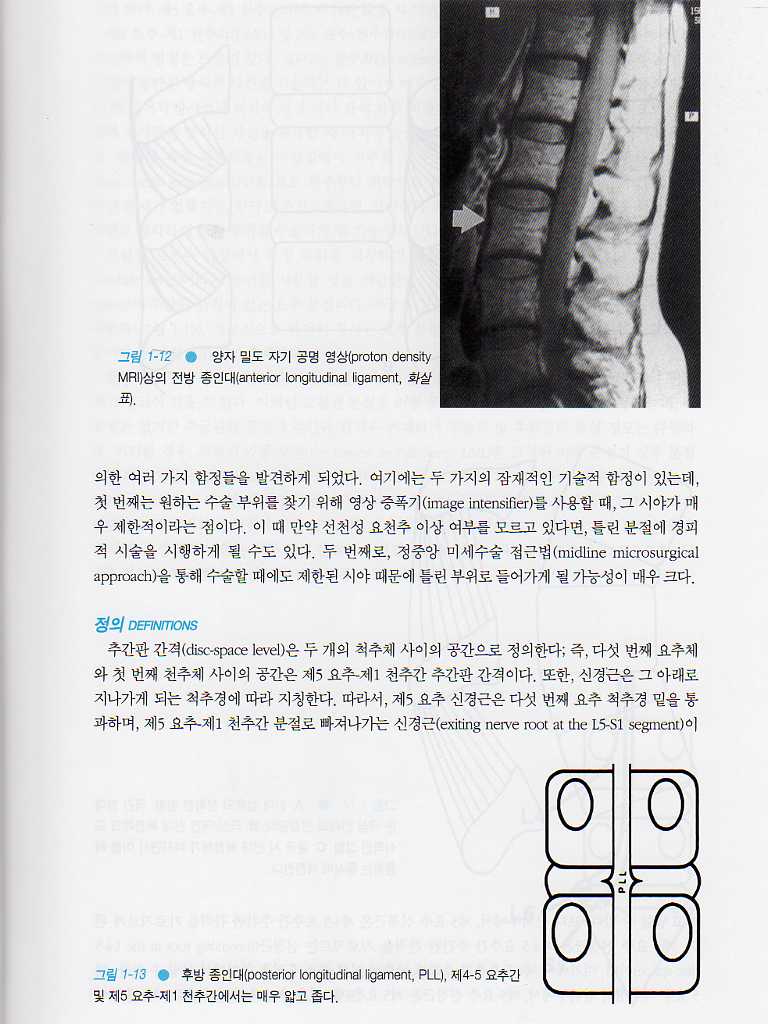 맥납의요통-Macnab's Backache4e