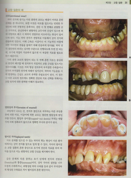 기능을 고려한 교합치료