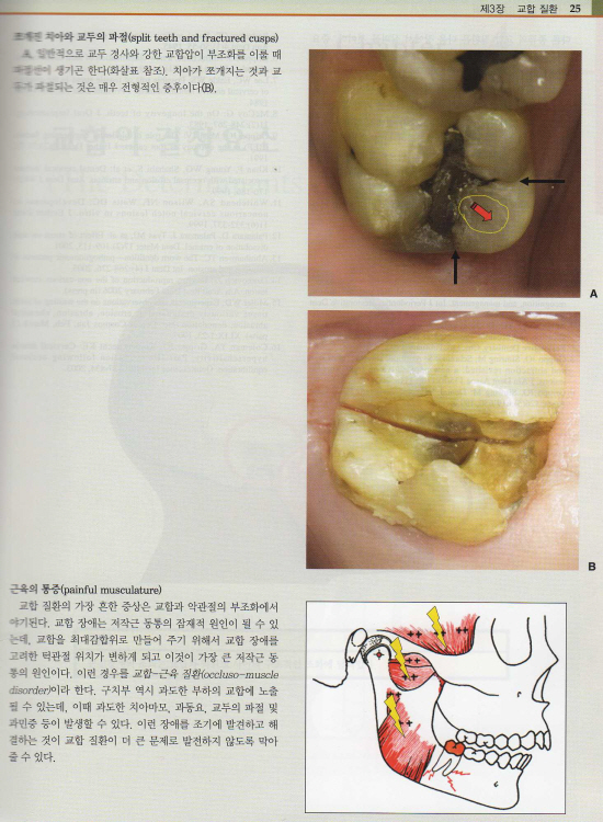 기능을 고려한 교합치료