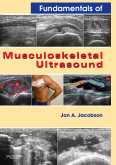Fundamentals of Musculoskeletal Ultrasound ,1/e