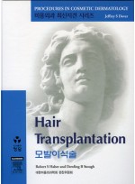 모발이식술 (DVD포함)