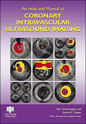 An Atlas and Manual of Coronary Intravascular Ultrasound Imaging