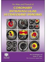 An Atlas and Manual of Coronary Intravascular Ultrasound Imaging