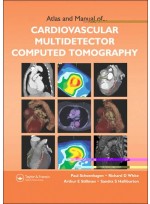 Atlas & Manual of Cardiovascular Multidetector Computed Tomography