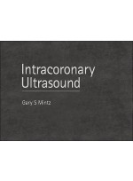 Atlas of Intracoronary Ultrasound