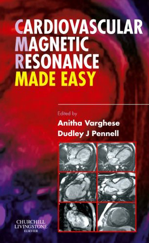 Cardiovascular Magnetic Resonance Made Easy