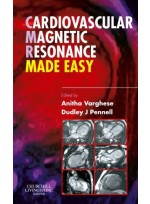 Cardiovascular Magnetic Resonance Made Easy
