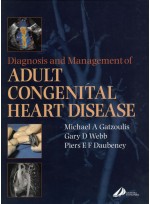 Diagnosis and Management of Adult Congenital Heart Disease