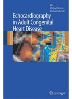 Echocardiography in Adult Congenital Heart Disease