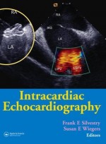 Intracardiac Echocardiography