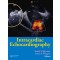 Intracardiac Echocardiography