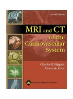MRI and CT of the Cardiovascular System, 2/e
