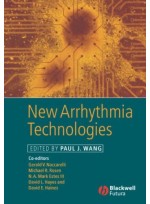 New Arrhythmia Technologies