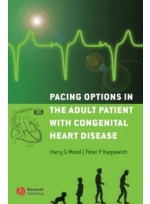 Pacing Options in the Adult Patient with Congenital Heart Disease