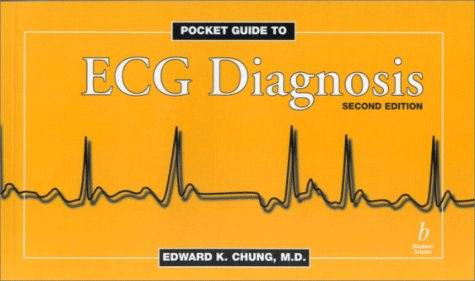 Pocket guide to ECG Diagnosis