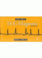 Pocket guide to ECG Diagnosis