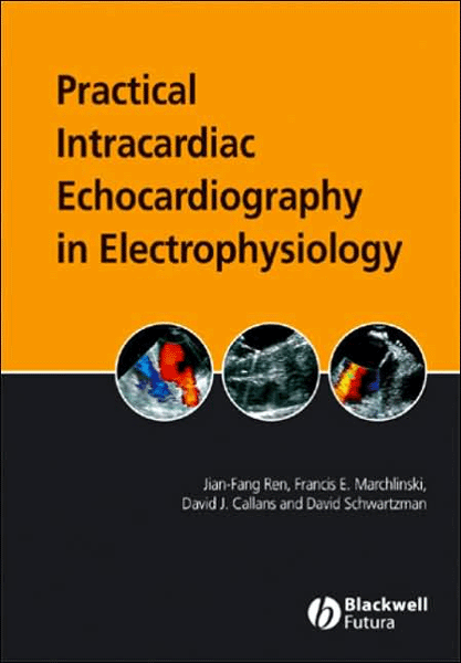 Practical Intracardiac Echocardiography in Electrophysiology