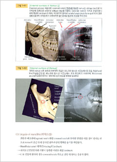 125% 확대된 Surgical Imagination