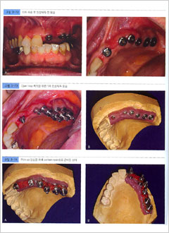 125% 확대된 Surgical Imagination