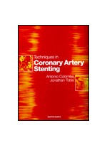 Techniques in Coronary Artery Stenting