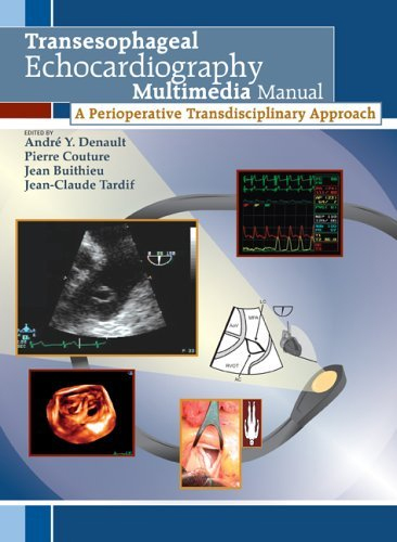 Transesophageal Echocardiography