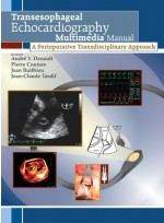 Transesophageal Echocardiography