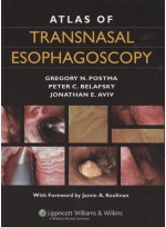 Atlas of Transnasal Esophagoscopy