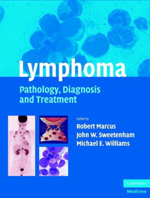 Lymphoma:Pathology Diagnosis & Treatment