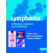 Lymphoma:Pathology Diagnosis & Treatment