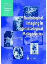 Radiological Imaging in Hematological Malignancies