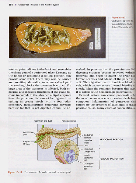 Human Diseases: A Systemic Approach, 6/e