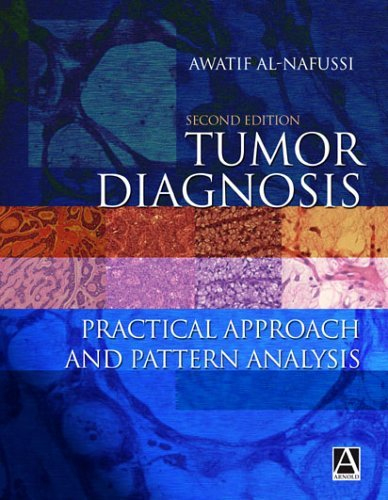 Tumor Diagnosis: Practical Approach and Pattern Analysis