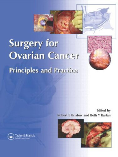Surgery for Ovarian Cancer: Principles and Practice