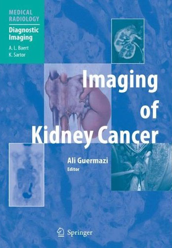 Imaging of Kidney Cancer