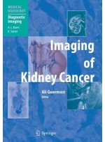 Imaging of Kidney Cancer