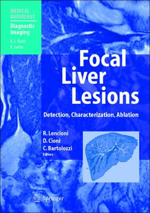 Focal Liver Lesions : Detection, Characterization, Ablation