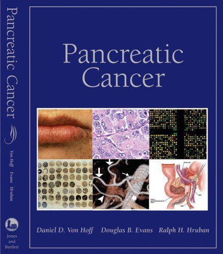 Pancreatic Cancer